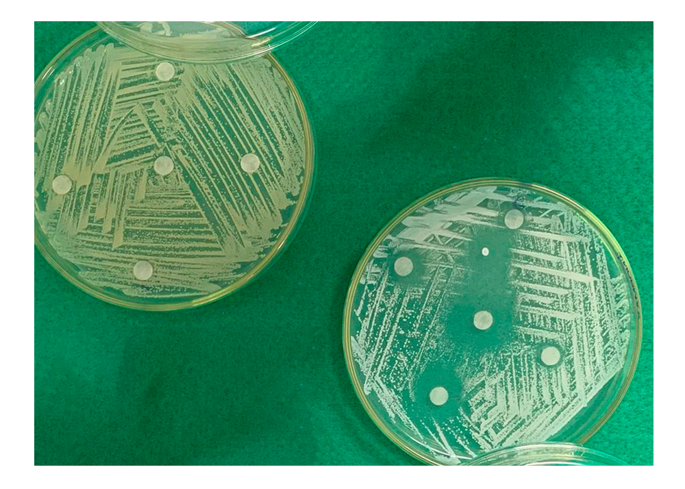 Determinação da atividade antimicrobiana por meio de difusão de disco